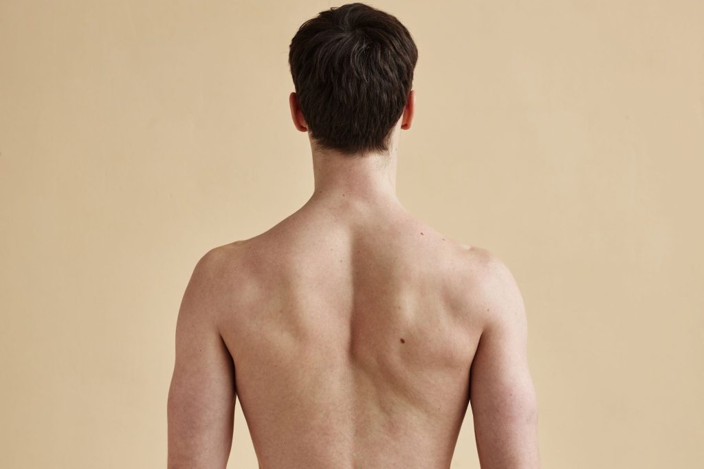 Ανδρική laser αποτρίχωση πλάτης σε δερματολογικό ιατρείο